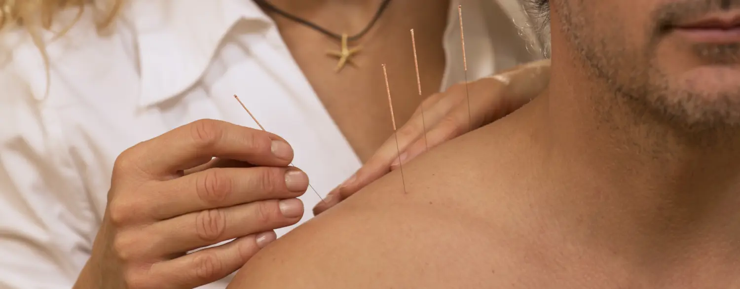 Ganzheitliche Naturheilpraxis Melanie Gold Chinesische Akupunktur